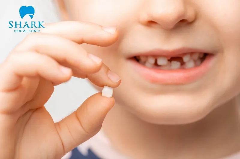 Bé bị ngã lung lay răng sữa các mẹ nên làm gì? 9 Trẻ bị ngã lung lay răng sữa mang nhiều hậu quả nguy hiểm