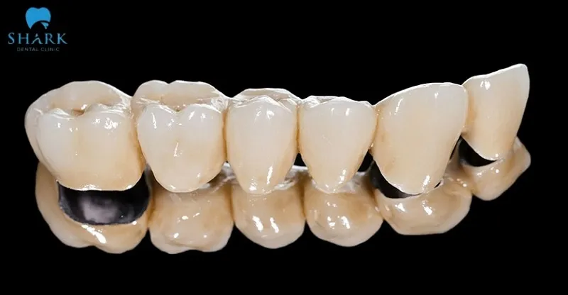 8 tác hại của răng sứ kim loại bạn nhất định phải biết 9 Quá trình chế tác răng sứ kim loại không đảm bảo tiêu chuẩn có thể gây ra tình trạng dư kim loại độc hại