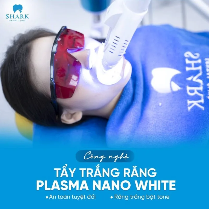 Nha Khoa Shark là địa chỉ tẩy trắng răng tại Hà Nội uy tín ứng dụng công nghệ tẩy trắng Plasma Nano White chất lượng