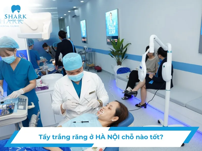Tẩy trắng răng ở Hà Nội