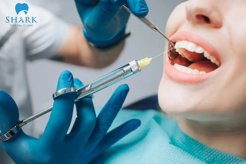 Cần sử dụng thuốc tê trước khi nhổ răng bởi chúng giúp hỗ trợ hiệu quả cho quá trình thực hiện