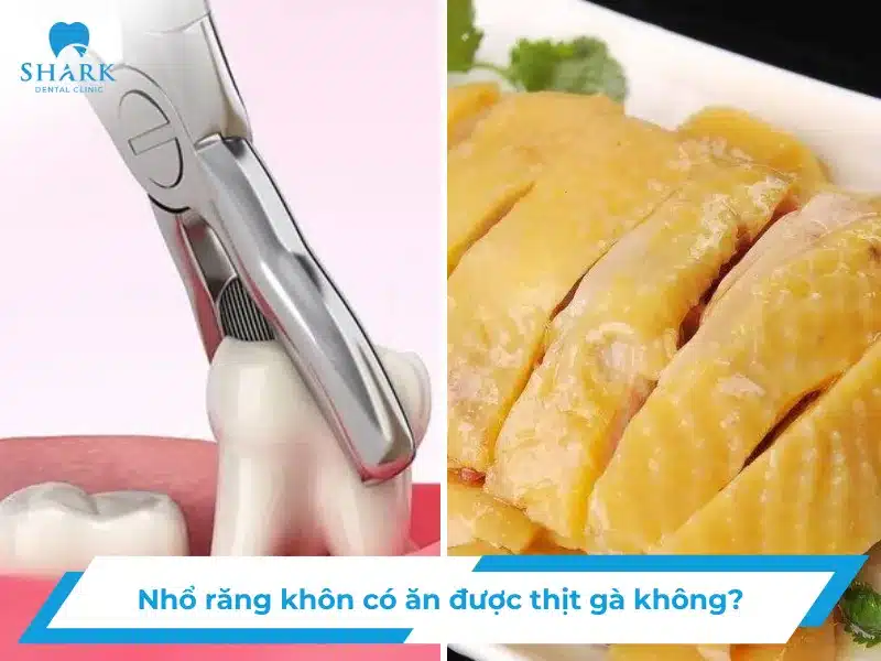 Nhổ răng khôn có ăn được thịt gà không