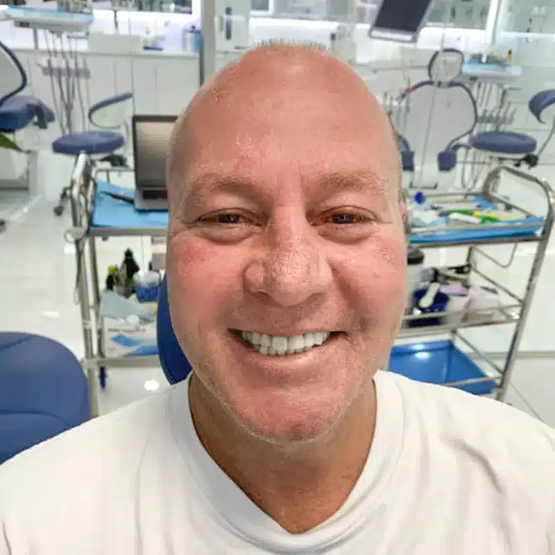 Làm răng sứ ở Shark Dental