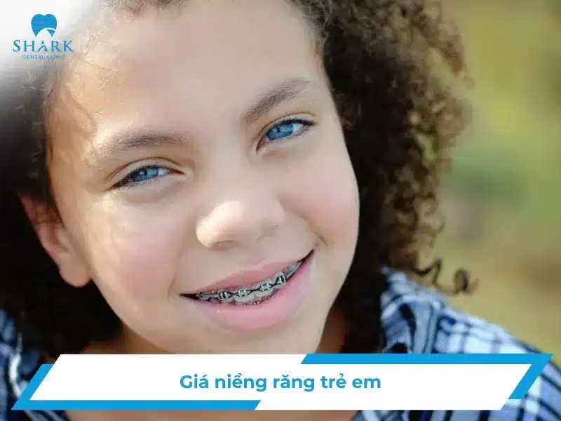 Giá niềng răng trẻ em