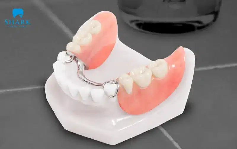 Hàm tháo lắp nhựa cứng là gì? Giá hàm giả bao nhiêu tiền? 15 Hàm cứng nên ban đầu sẽ gây cảm giác khó chịu