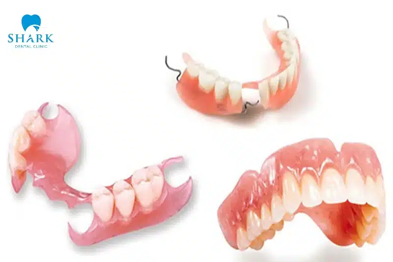 Hàm tháo lắp nhựa cứng là gì? Giá hàm giả bao nhiêu tiền? 12 Hàm tháo lắp bắn phần và toàn hàm