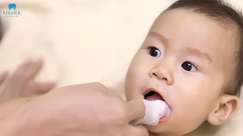 Nanh sữa ở trẻ là gì? Hình ảnh trẻ bị nanh sữa và cách xử lý 22 Rơ miệng cho bé nhằm ngăn chặn vi khuẩn phát triển và tránh để nanh sữa bị viêm nhiễm