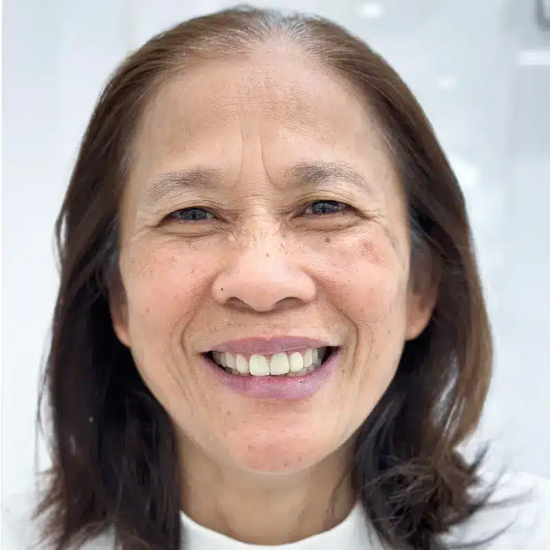 Khách hàng bọc sứ ở Shark Dental