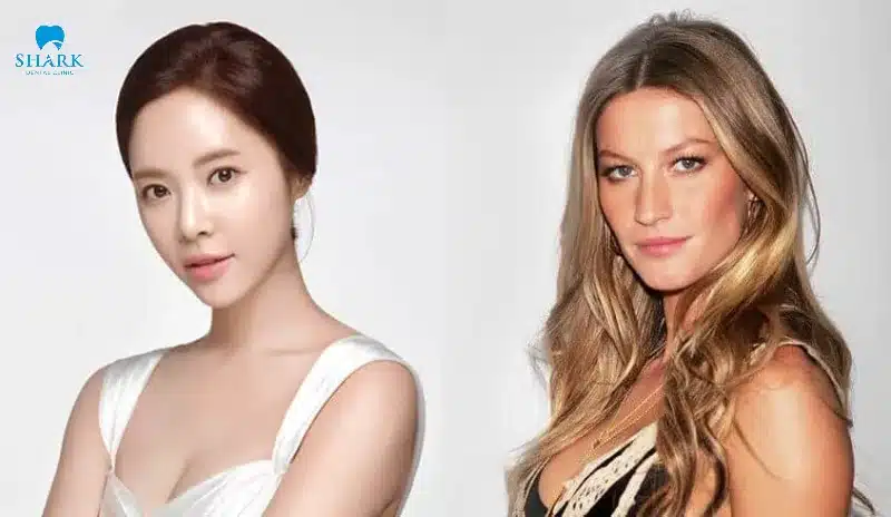 Mặt dài có tổng thể khuôn mặt giống hình chữ nhật