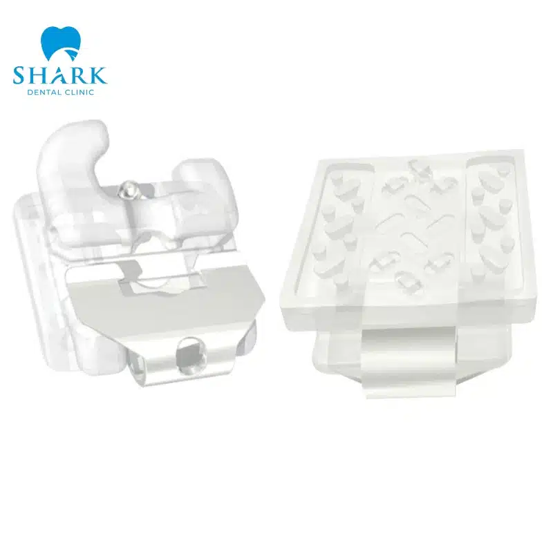 Niềng răng mắc cài sứ tự buộc là gì? Giá bao nhiêu tiền? 13 Mắc cài sứ trong suốt nên khó thấy khi giao tiếp