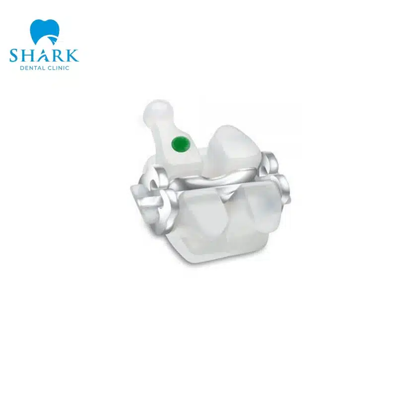Niềng răng mắc cài sứ tự buộc là gì? Giá bao nhiêu tiền? 14 Thiết kế mắc cài nhỏ gọn và dễ vệ sinh