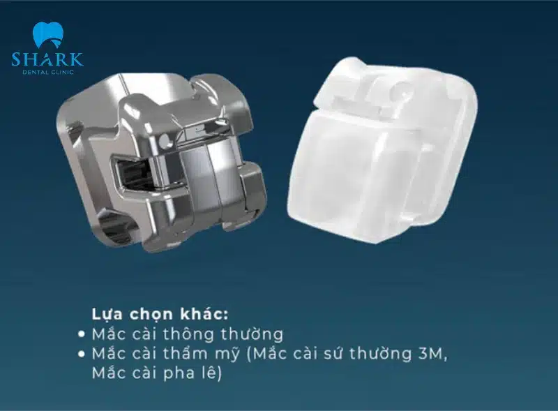 Niềng răng mắc cài kim loại tự buộc là gì? Giá bao nhiêu tiền? 14 Chi phí niềng mắc cài tự buộc sẽ cao hơn truyền thống và nếu chọn mắc cài sứ thì giá thành sẽ cao hơn nữa
