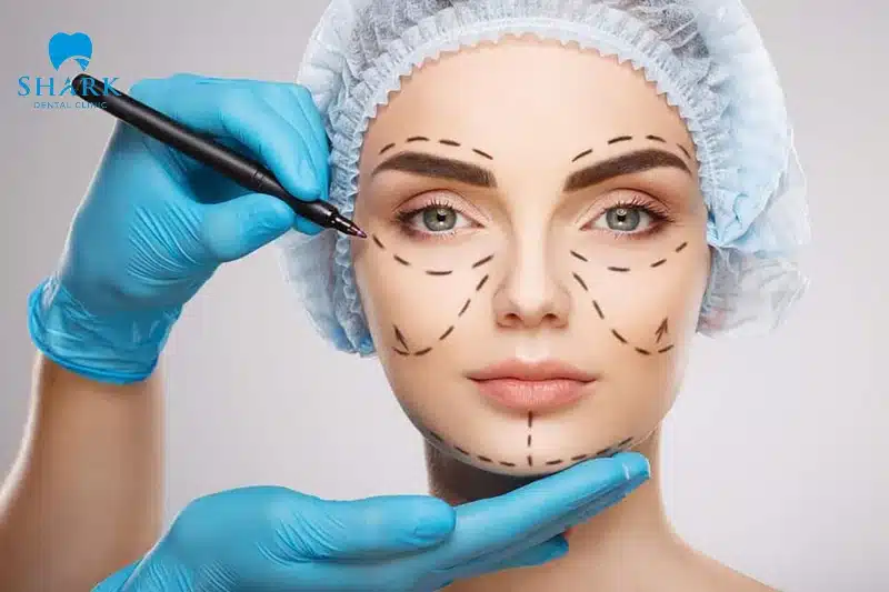 Mặt kim cương: Đặc điểm và ý nghĩa tướng số tốt hay xấu 27 Phẫu thuật tạo mặt kim cương