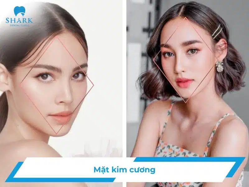 Mặt kim cương