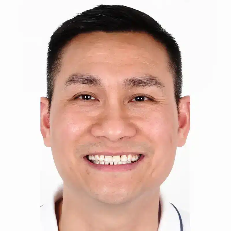 Khách hàng trồng răng