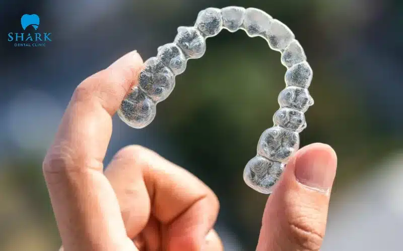 Niềng răng trong suốt Invisalign là gì? Có ưu điểm gì? 11 Khay niềng Invisalign