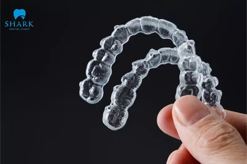 Niềng răng trong suốt Invisalign là gì? Có ưu điểm gì? 17 Invisalign có chi phí cao hơn các phương pháp khác là do vật liệu độc quyền và quá trình chế tác