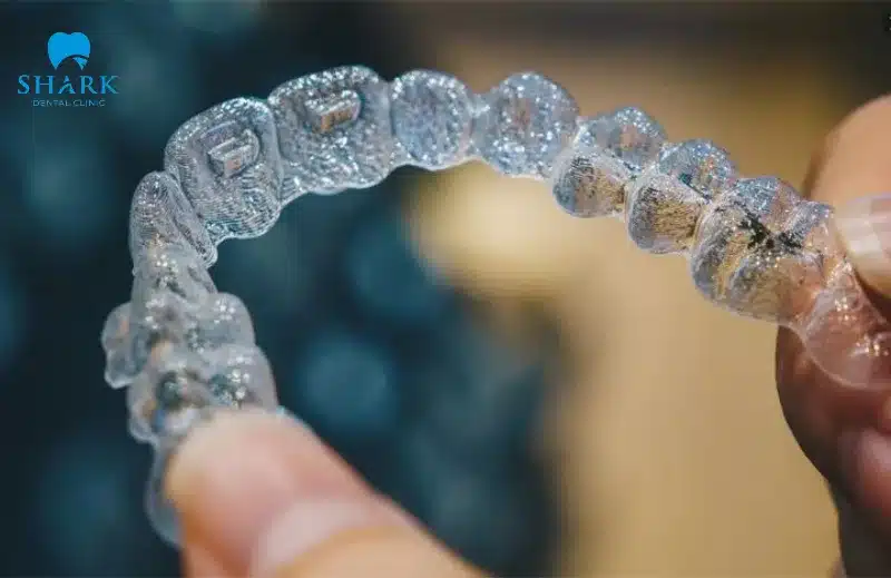 Niềng răng trong suốt Invisalign là gì? Có ưu điểm gì? 16 Khay niềng trong suốt Invisalign