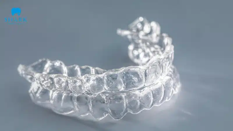 Quy trình niềng răng gồm các giai đoạn nào? Có mấy bước? 17 Khay niềng được thiết kế theo đúng với kế hoạch 3D đã chốt