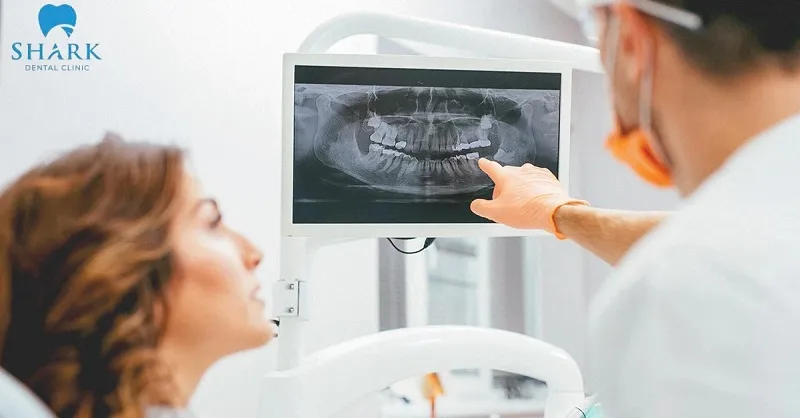 Bác sĩ sẽ chụp X-quang để kiểm tra tình trạng răng, từ đó xác định phương pháp điều trị phù hợp 