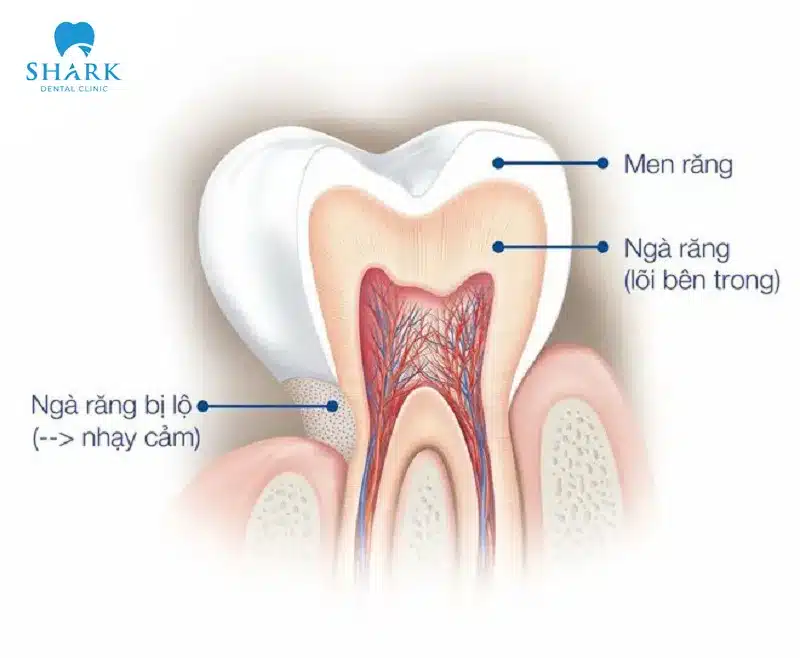 Ngà răng bị lộ là gì? Có nguy hiểm không và điều trị sao? 7 Ngà răng là bộ phận quan trọng có vai trò đặc biệt, bảo vệ tủy răng