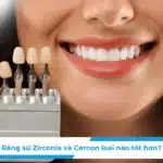 Răng sứ Zirconia và Cercon loại nào tốt hơn?