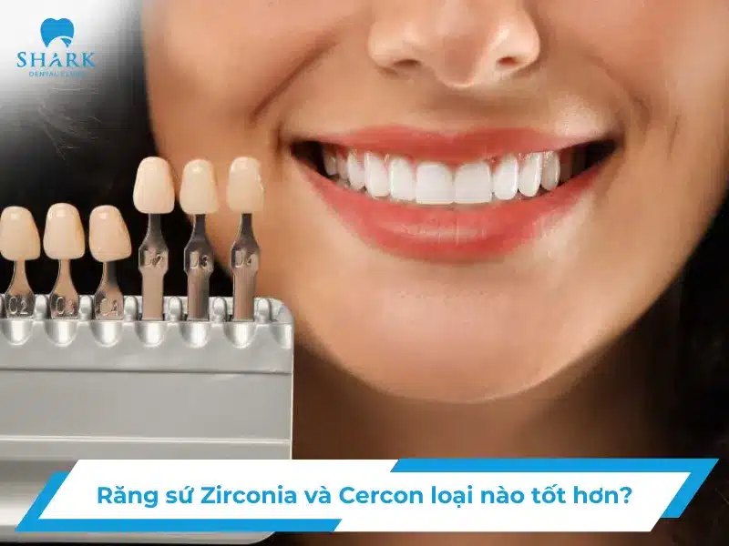 Răng sứ Zirconia và Cercon loại nào tốt hơn?