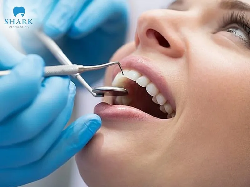 Khi phát hiện vùng xung quanh miếng trám bị đổi màu, khách hàng cần đến nha khoa để được thực hiện tái trám răng. 