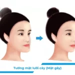 Mặt lưỡi cày