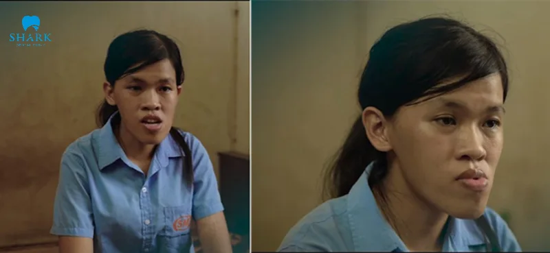 Con gái mặt lưỡi cày không thuận lợi trong công việc
