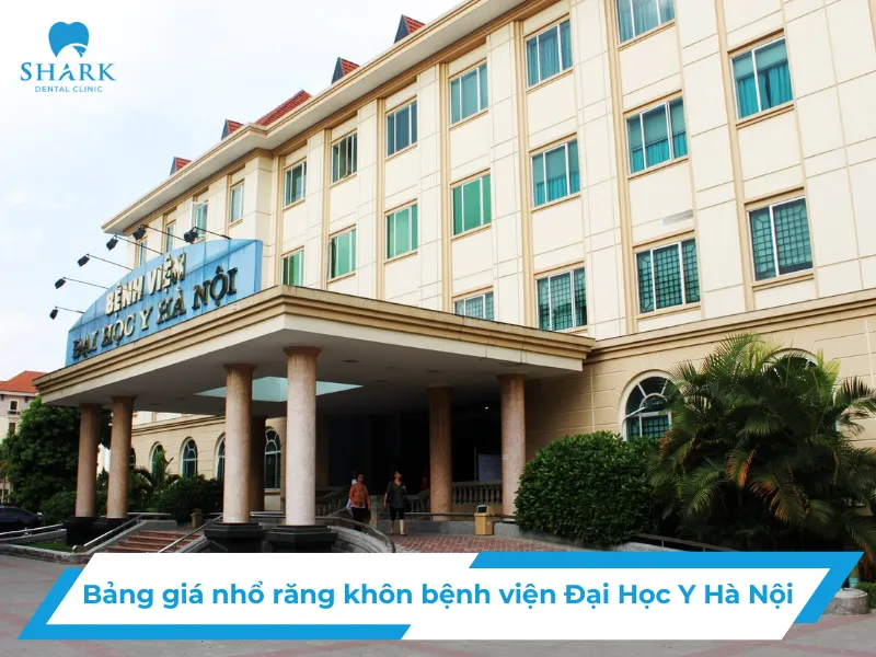 Bảng giá nhổ răng khôn bệnh viện Đại Học Y Hà Nội