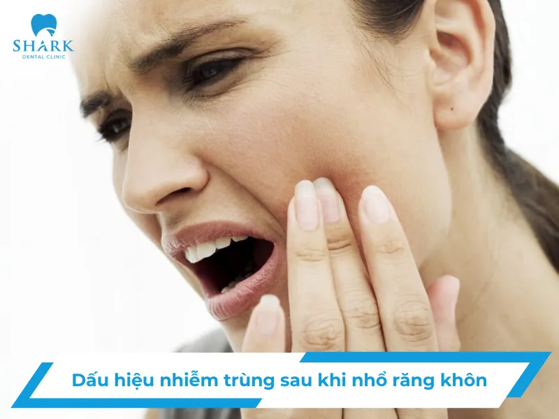 Dấu hiệu nhiễm trùng sau khi nhổ răng khôn
