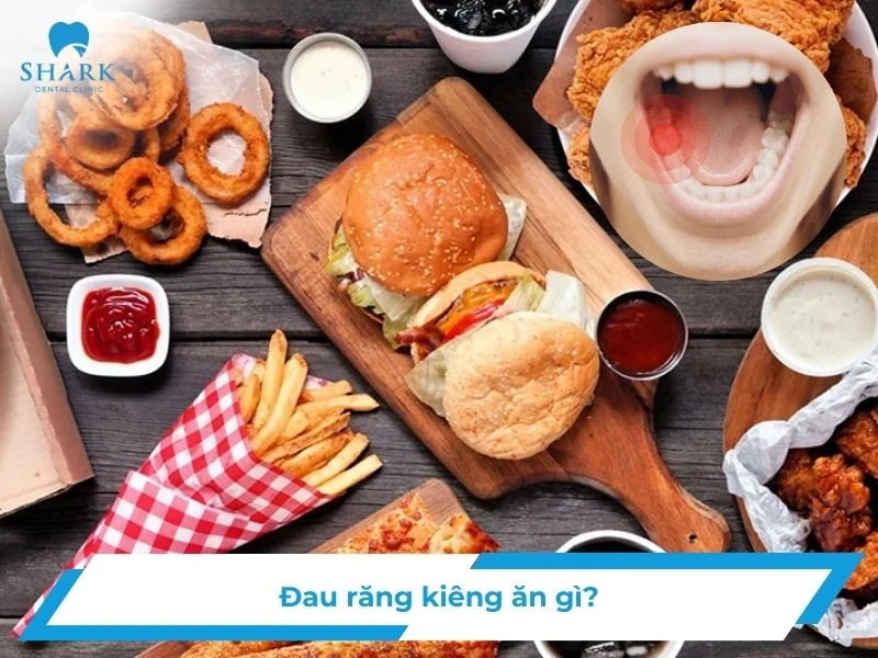 Đau răng kiêng ăn gì