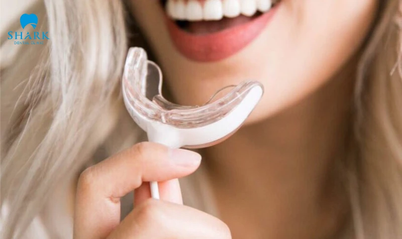 Top 11 máy làm trắng răng tốt và an toàn hiện nay 28 Không sử dụng máy trắng răng khi đang mắc các bệnh lý về răng miệng