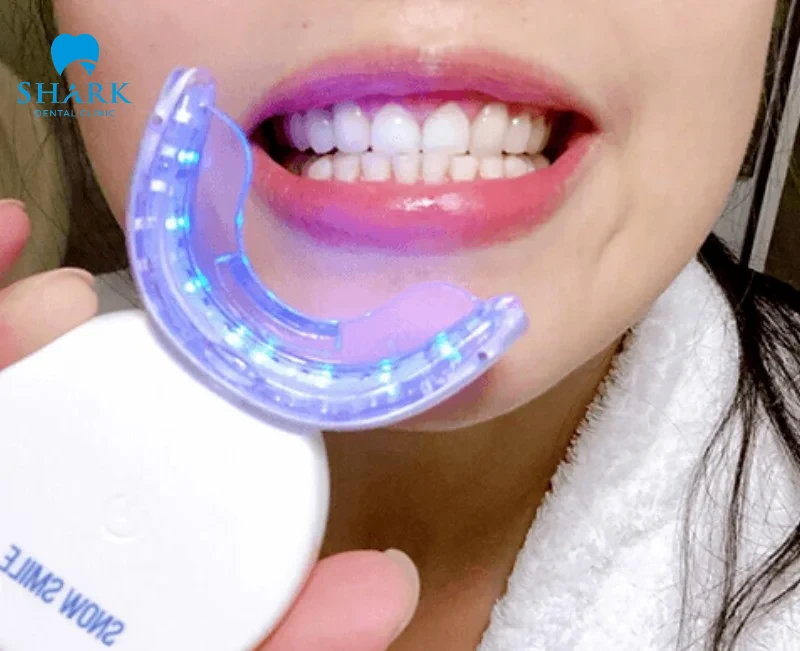 Top 11 máy làm trắng răng tốt và an toàn hiện nay 16 Dùng máy tẩy trắng răng có mang lại hiệu quả tùy thuộc vào sự kiên nhẫn của bạn