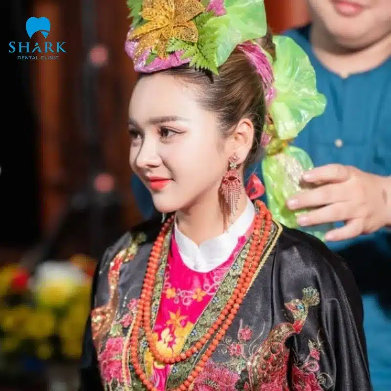 Gương mặt người có căn đồng có đặc điểm gì để nhận biết? 13 Căn cô Bơ