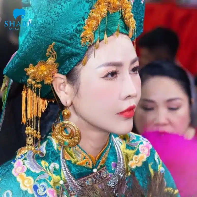Gương mặt người có căn đồng có đặc điểm gì để nhận biết? 9 Gương mặt người có căn đồng