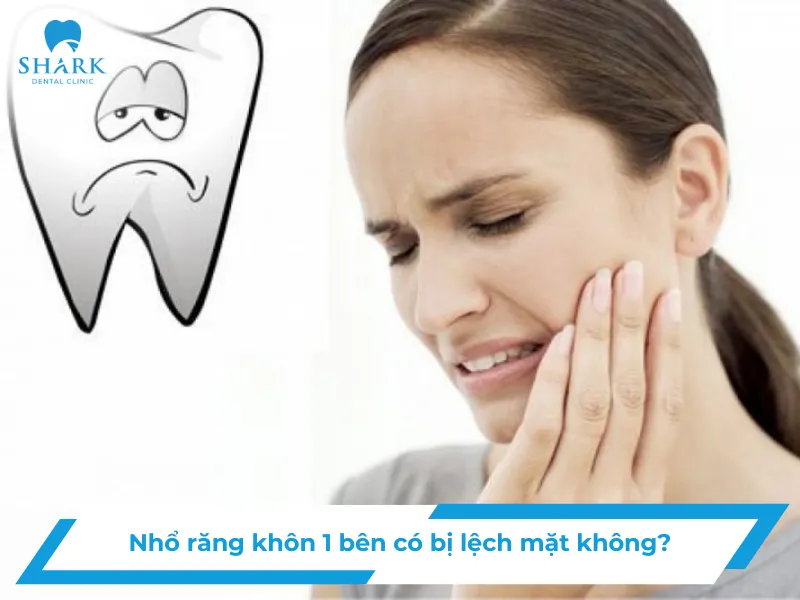 Nhổ răng khôn 1 bên có bị lệch mặt không