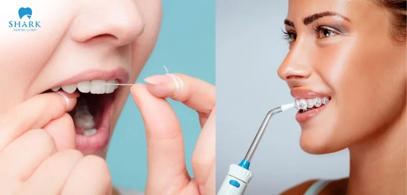Nhổ răng khôn ăn thịt bò được không? Cần chú ý những gì? 9 Sử dụng tăm nước và chỉ nha khoa để vệ sinh răng miệng