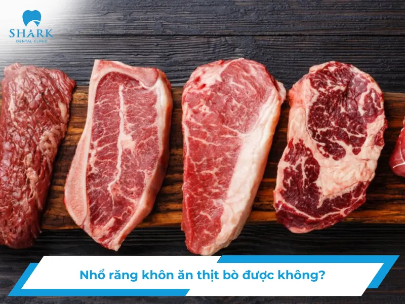 Nhổ răng khôn ăn thịt bò được không?