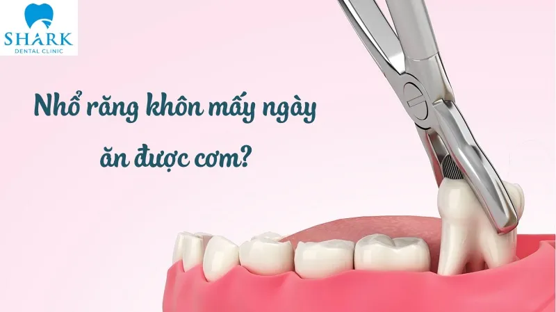 Sau khi nhổ răng khôn có ăn cơm được không?