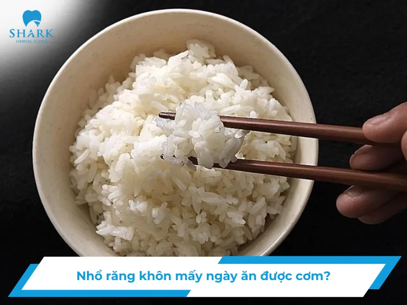 Nhổ răng khôn mấy ngày ăn cơm
