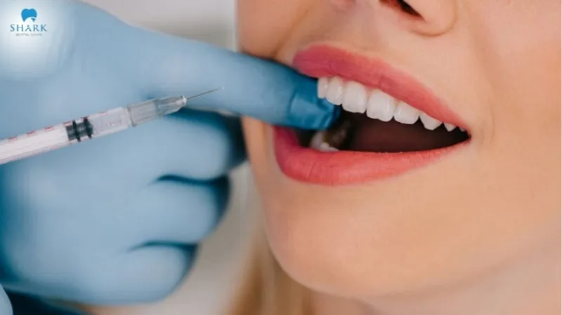Bác sĩ giải đáp: Răng khôn bị sâu có nên nhổ không? 13 Nhổ răng khôn bị sâu sẽ không đau do các bác sĩ đã gây tê trước khi thực hiện