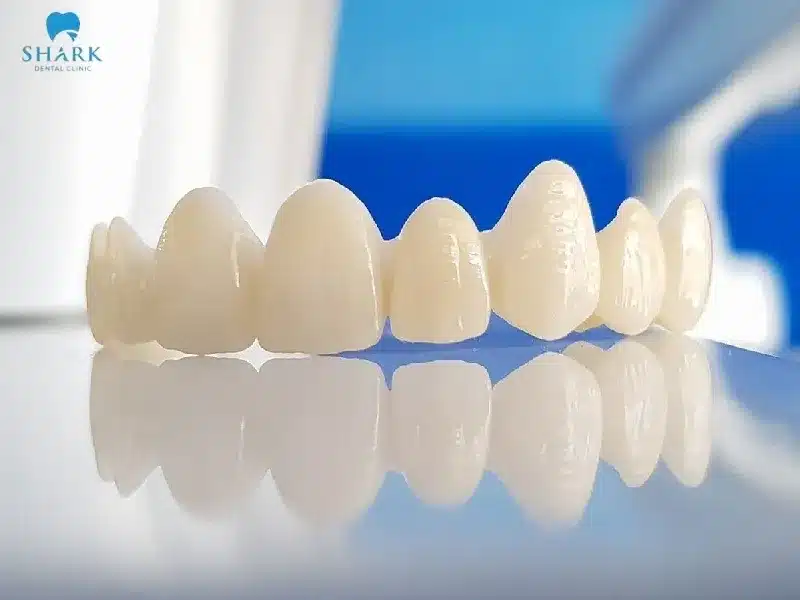 So sánh răng sứ Zirconia và Cercon? Nên chọn loại nào? 6 Răng sứ Zirconia là loại răng toàn sứ cao cấp có xuất xứ từ Đức, được chế tác nguyên khối từ sứ Zirconia