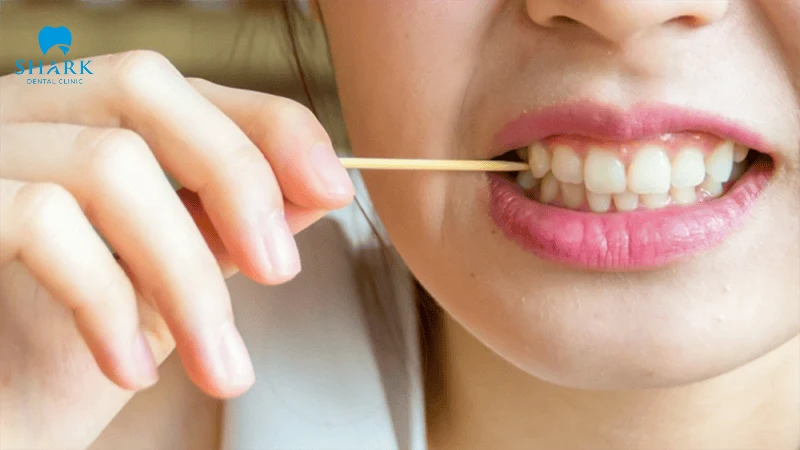 Lấy tăm bị kẹt trong kẽ răng