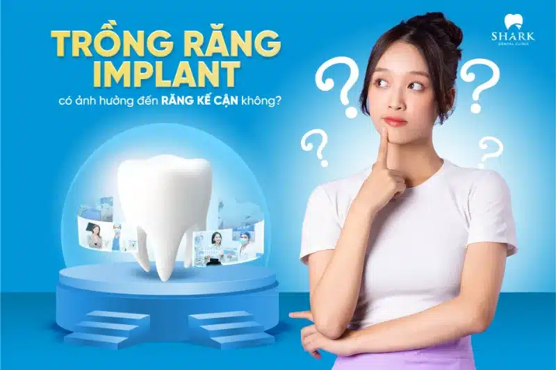 So sánh cầu răng sứ và Implant có gì khác biệt? 12 Cấy Implant không làm ảnh hưởng đến răng liền kề