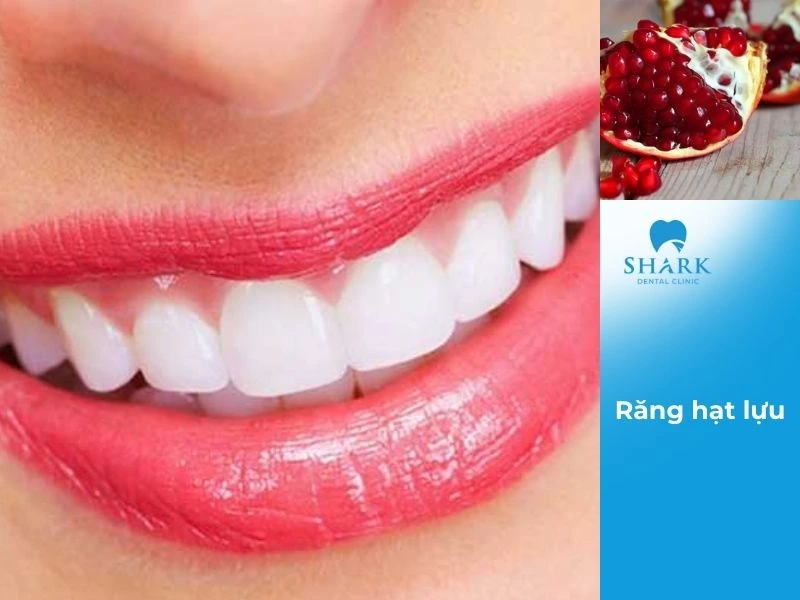 Người sở hữu tướng răng hạt lựu sẽ gặp nhiều may mắn trong cuộc sống