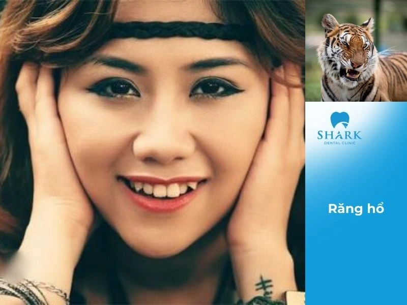 Dáng răng hổ thể hiện sự thành công trên con đường sự nghiệp