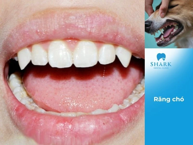 Người sở hữu dáng răng chó thường ăn nói hoang đường và không nhận được sự tin tưởng từ mọi người