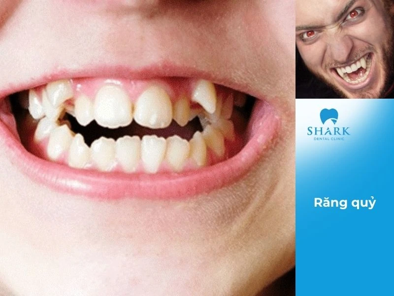 Dáng răng quỷ thể hiện người thường gặp khó khăn và thất bại trong công việc